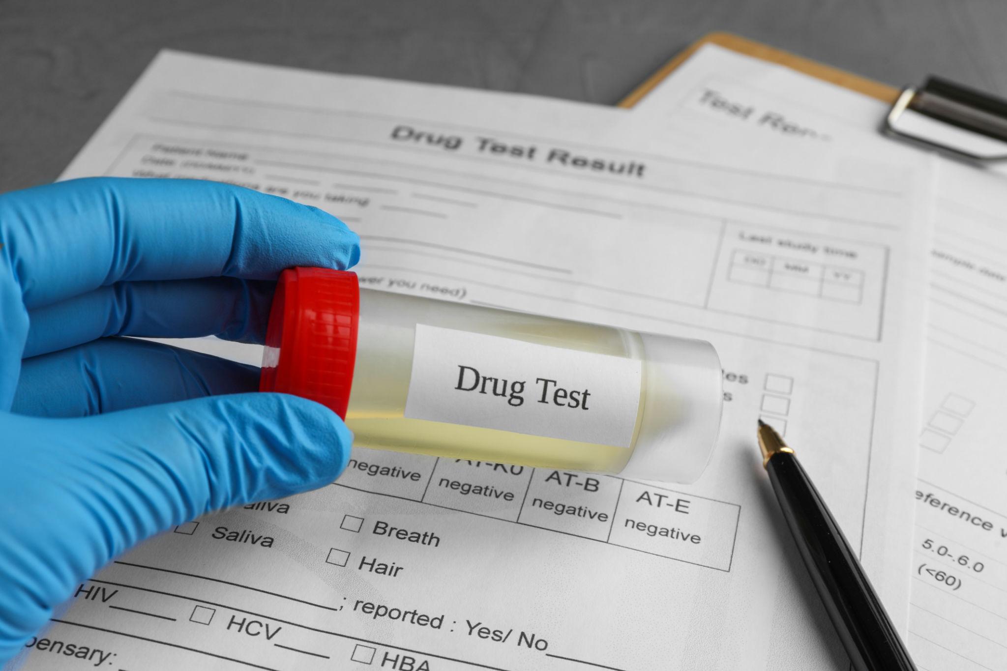 Drug Screening